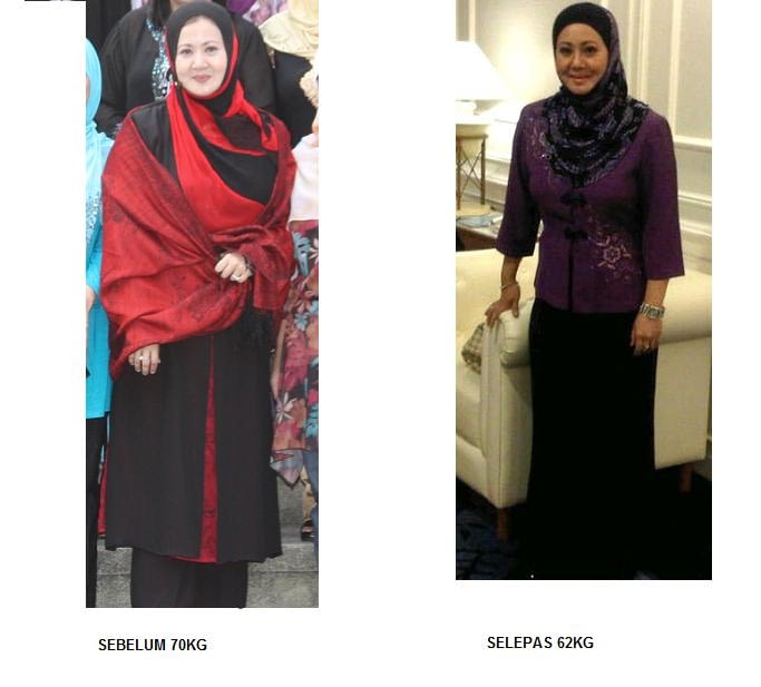 Testimoni Sendiri Hazura Hashim Bani - Keto Low Carbs Diet